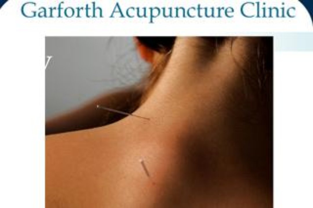 Garforth Acupuncture Clinic, Garforth, Leeds