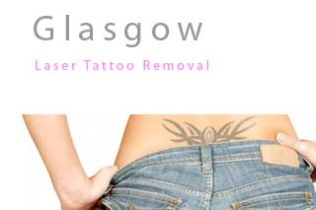 Glasgow Tattoo Removal at Greens Health And Fitness, Anderston, Glasgow