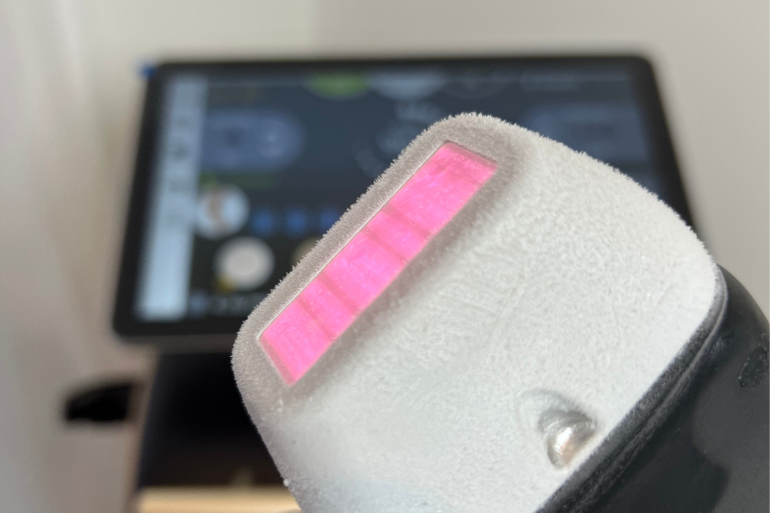 Laser Pro Beauty, Museum Vleeshuis, Antwerpen