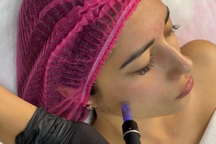 Estética facial by Iryna Zabolotnia - Soin visage Cartagena - Photo de galerie - OneBooking