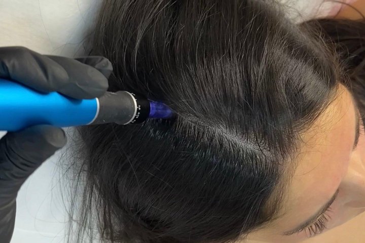 Estética facial by Iryna Zabolotnia - Soin visage Cartagena - Photo de galerie - OneBooking