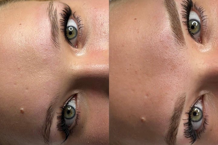 Estética facial by Iryna Zabolotnia - Soin visage Cartagena - Photo de galerie - OneBooking