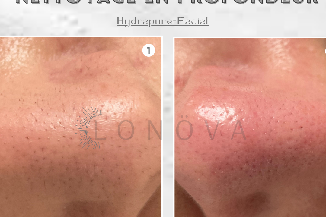 LONÖVA, Drancy, Seine-Saint-Denis