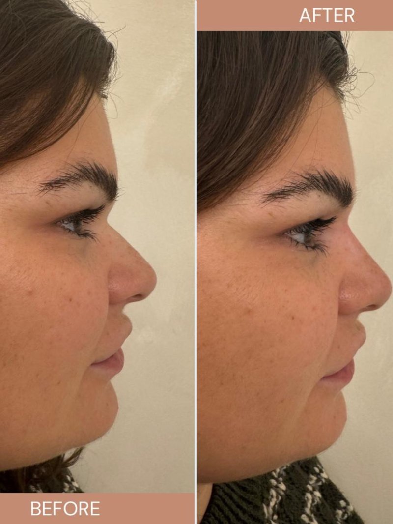AA Aesthetics - Amy, Nurse Prescriber | Skin Clinic in Canary