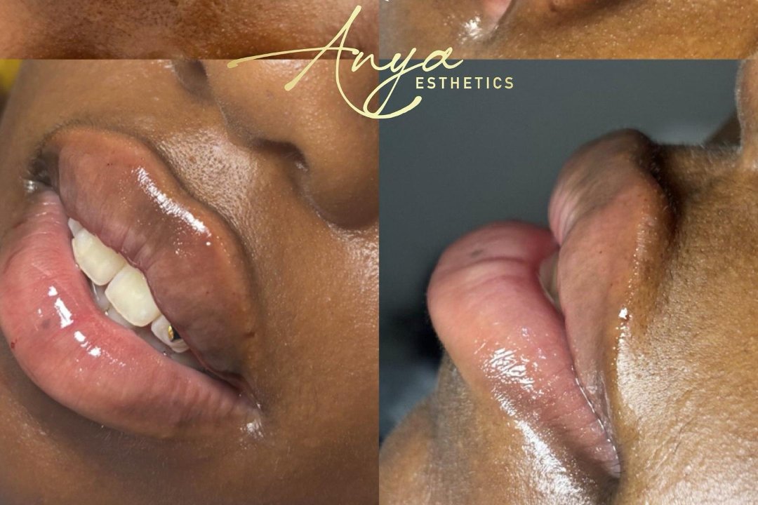 Anya Esthetics, All Saints, London