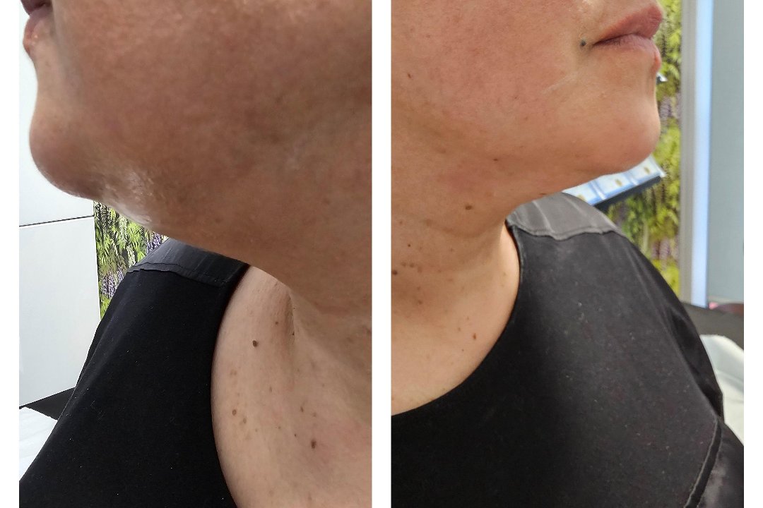 Glam Beauty Aesthetics, Bryanston Square, London