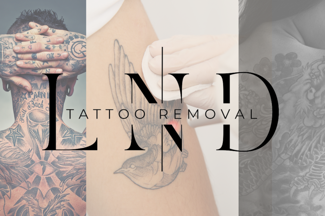 London Laser Tattoo Removal, Argyle Square, London