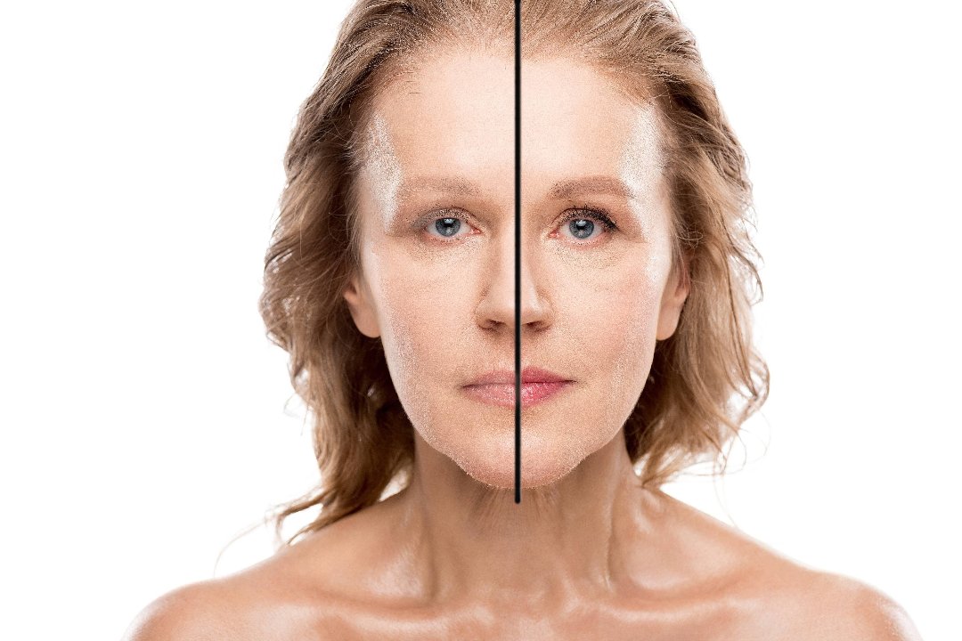 Permanent Makeup Madrid, Príncipe de Vergara, Madrid