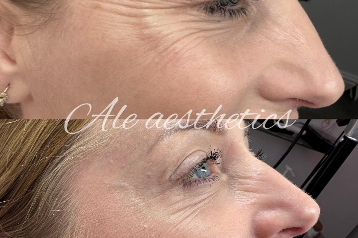 Ale Aesthetics - Coiffure Leeds - Photo de galerie - OneBooking