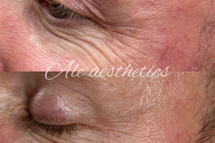 Ale Aesthetics - Coiffure Leeds - Photo de galerie - OneBooking