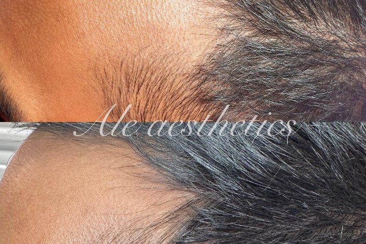Ale Aesthetics - Coiffure Leeds - Photo de galerie - OneBooking
