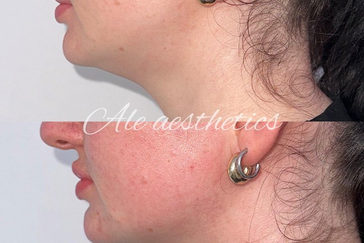 Ale Aesthetics - Coiffure Leeds - Photo de galerie - OneBooking