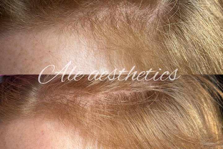 Ale Aesthetics - Coiffure Leeds - Photo de galerie - OneBooking