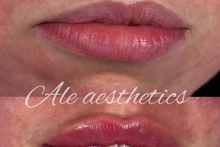 Ale Aesthetics - Coiffure Leeds - Photo de galerie - OneBooking