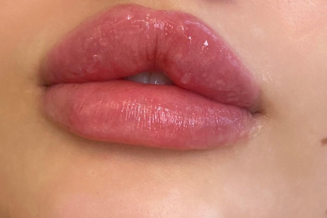 Beauty Fillers UK, Clapham Junction, London