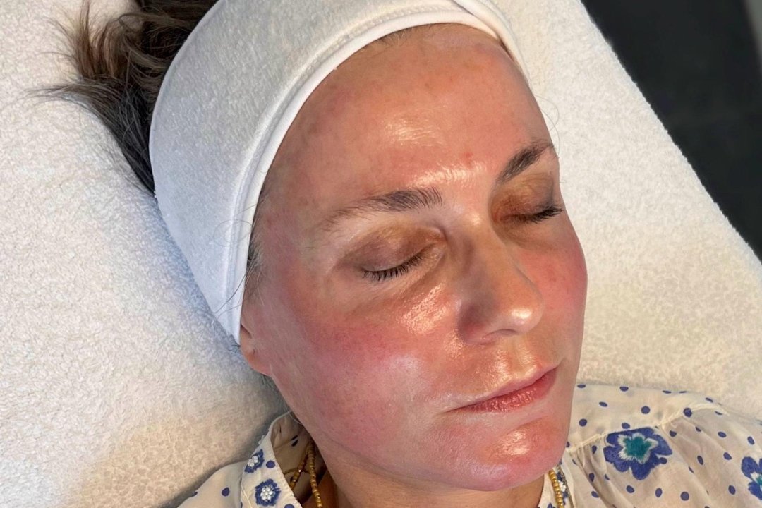 0.1SKINCARE, zu weiteren Stadtteilen, Stuttgart