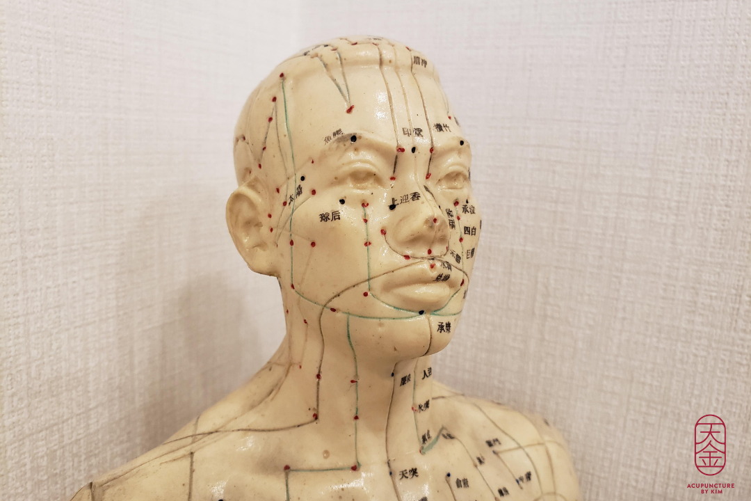 Acupuncture by Kim, Jan Schaeferbrug, Amsterdam