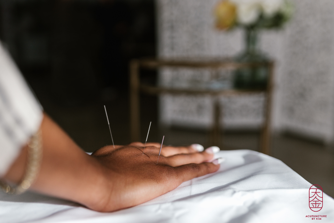 Acupuncture by Kim, Jan Schaeferbrug, Amsterdam