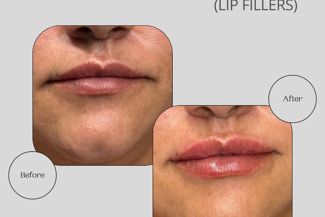 Eren Aesthetics, Enfield Chase, London