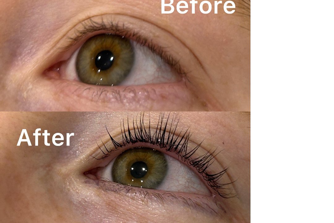 Urvi Beauty&clinic, Saint John's, London