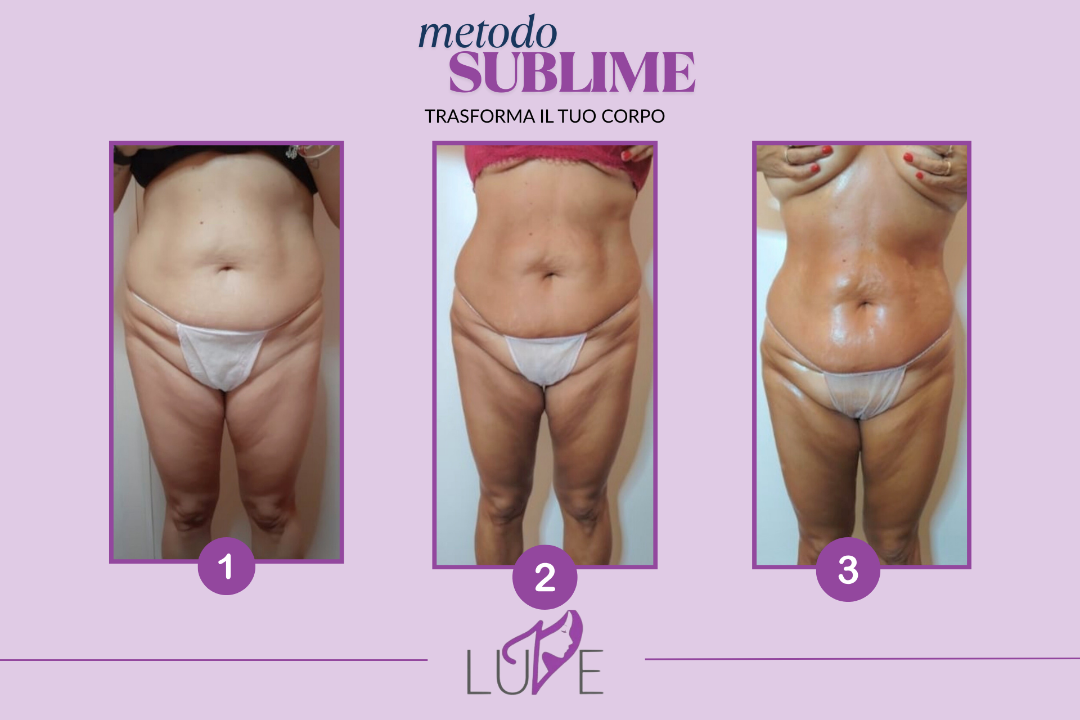 LUVE - Skin & Body Lab | Senago, Senago, Lombardia