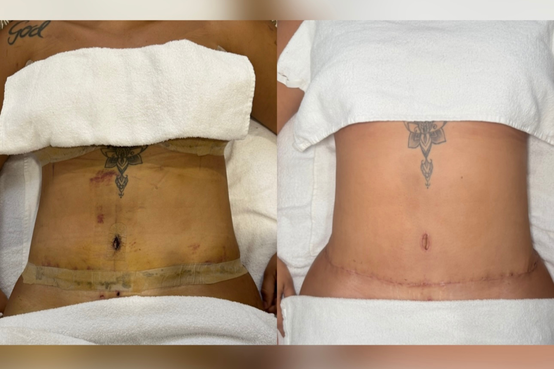 Lizane Santos Estética Avançada, Amadora