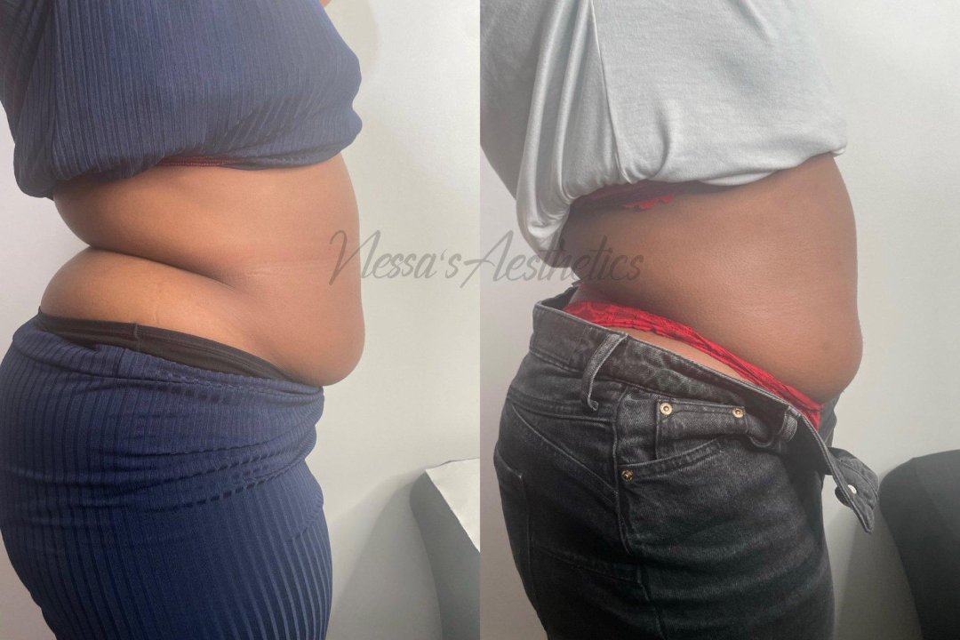 Nessa’s Aesthetics, Brixton, London