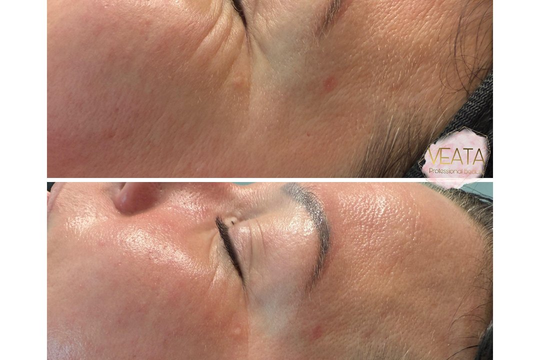VEATA Professional Beauty, Kreis 11, Zürich
