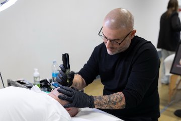 Paolo Quartuccio Trigopigmentazione