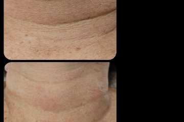 Lumiere Aesthetics & Wellness