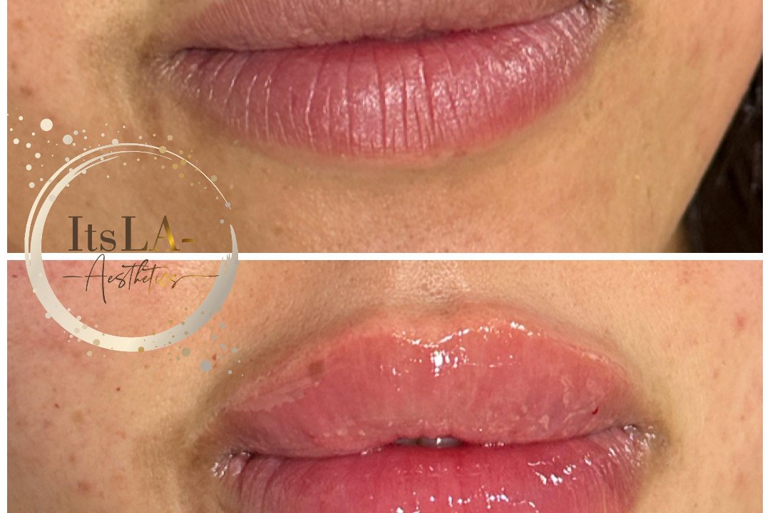 ItsLA-Aesthetics, Woolwich Arsenal, London