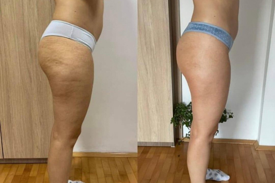 Maderostar, St. Alban, Basel