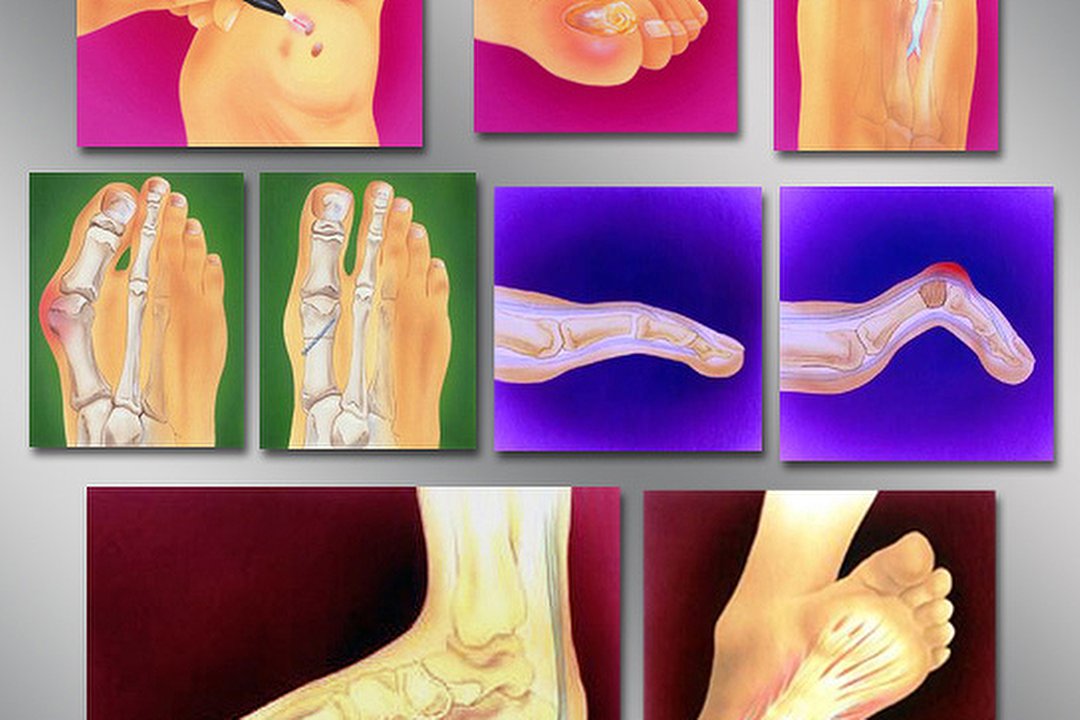 Nutley Foot Clinic, Worthing, West Sussex