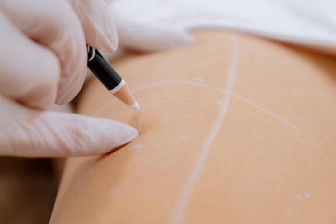 Aura Wellness Hamburg (bei Bali Spa), Billstedt, Hamburg