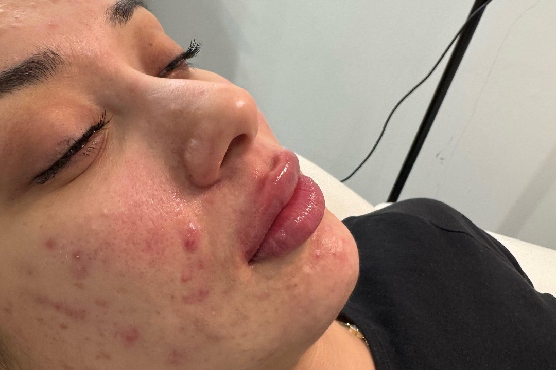 Diana Beauty Clinic London, Enfield Highway, London