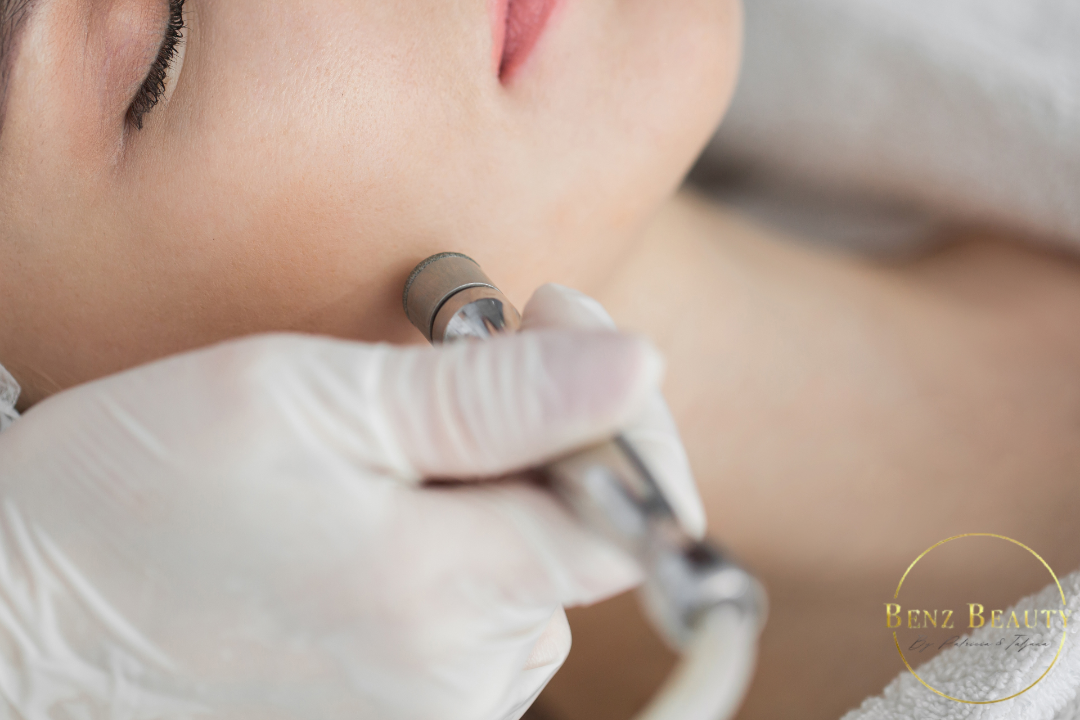 Benz Beauty Münster, Innenstadt, Münster