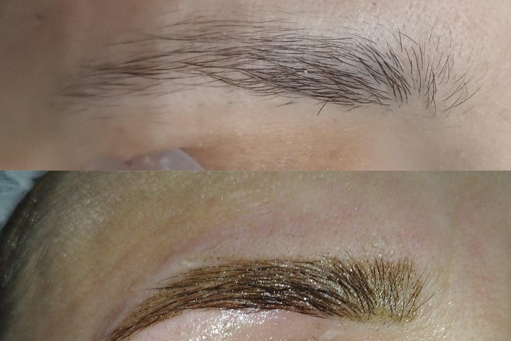 La Peonia Centro Epilazione Laser ed Estetica - Épilation Catania - Photo de galerie - OneBooking