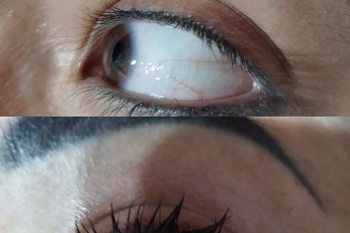 La Peonia Centro Epilazione Laser ed Estetica - Épilation Catania - Photo de galerie - OneBooking