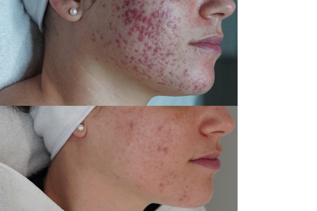 MSLY AESTHETICS STUTTGART, Rathaus, Stuttgart