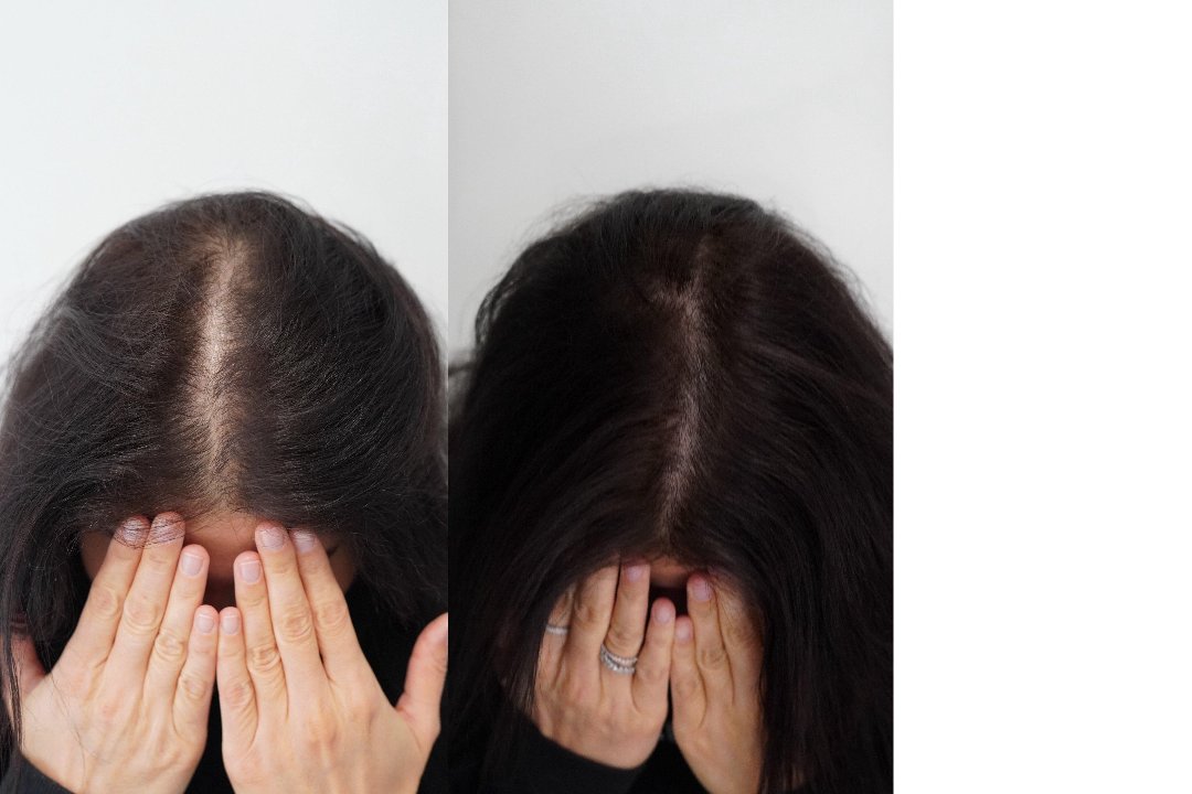 MSLY AESTHETICS KÖLN, Ehrenfeld, Köln