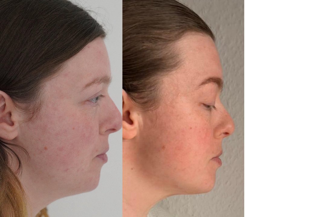 MSLY AESTHETICS STUTTGART, Rathaus, Stuttgart