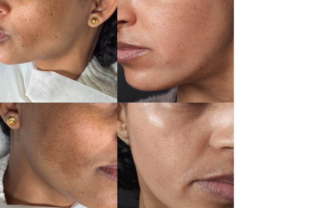 MSLY AESTHETICS STUTTGART, Rathaus, Stuttgart