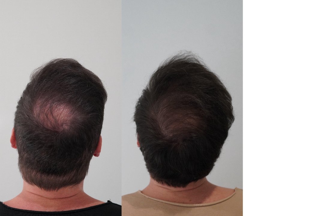 MSLY AESTHETICS STUTTGART, Rathaus, Stuttgart