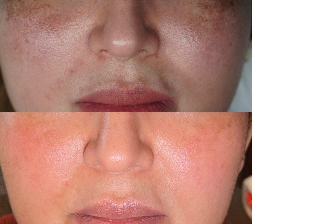 MSLY AESTHETICS STUTTGART, Rathaus, Stuttgart