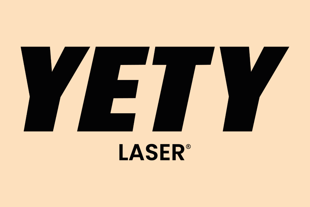 YETY LASER, Rue de Maubeuge, Paris