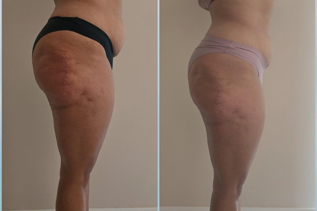 Alquimia Body, Zaidín-Vergeles, Granada