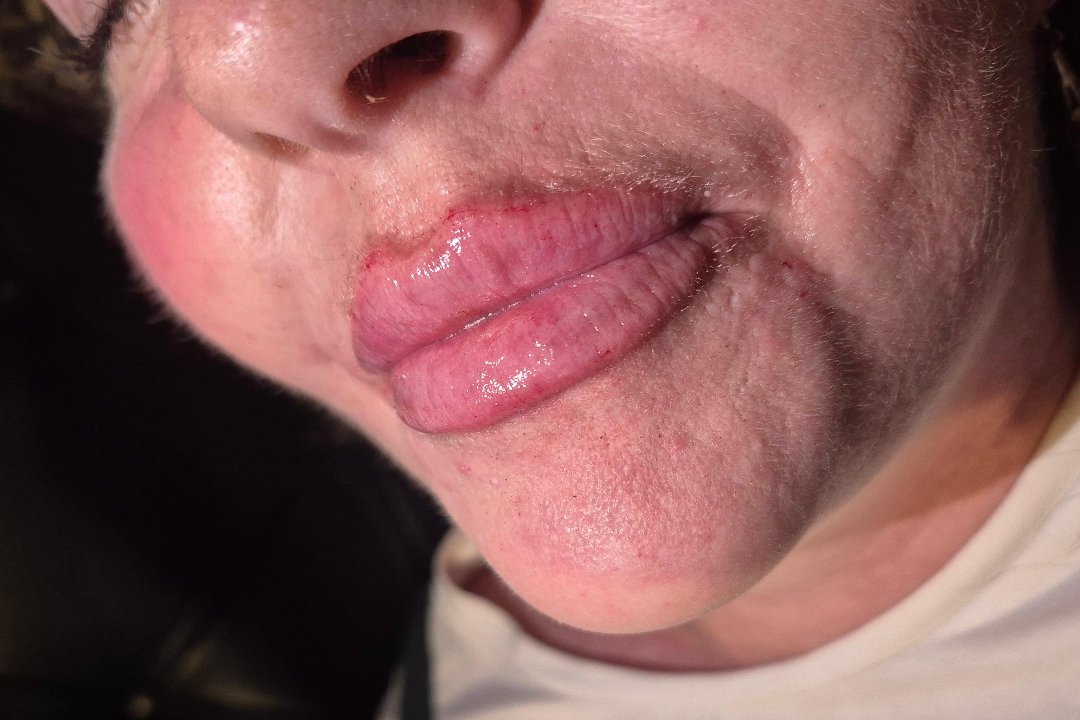 LC Skin & Aesthetics, Cottingley, Leeds