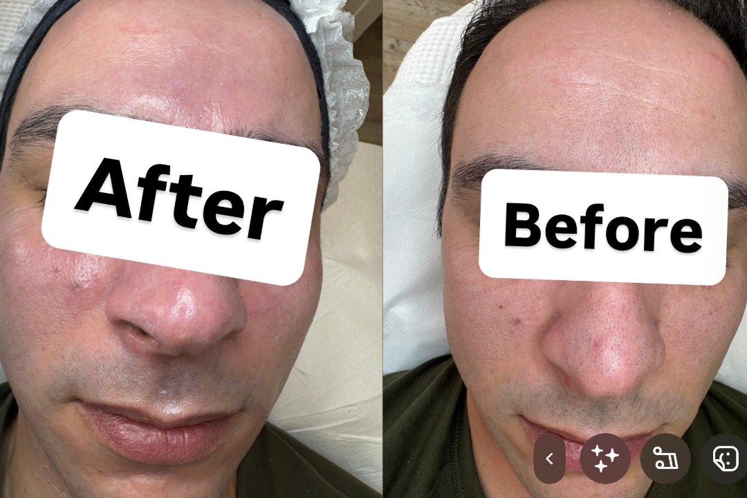 Laser perfection, Zoeterwoudseweg, Leiden