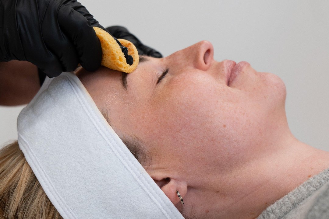 Simply Aesthetics Essex, Tiptree, Essex