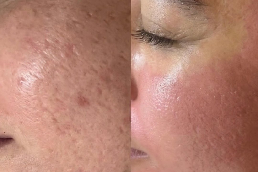 Haut Atelier 8, Innenstadt, Würzburg